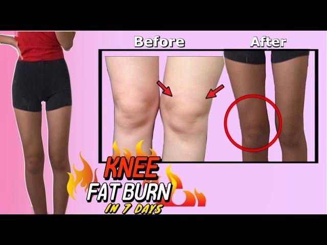 KNEE FAT BURN WORKOUT  get TONED model legs