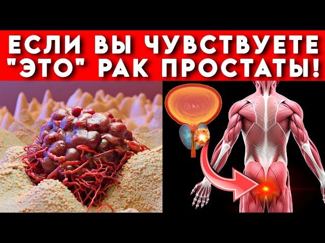 Рак простаты — Первые признаки и симптомы. Не игнорируйте!