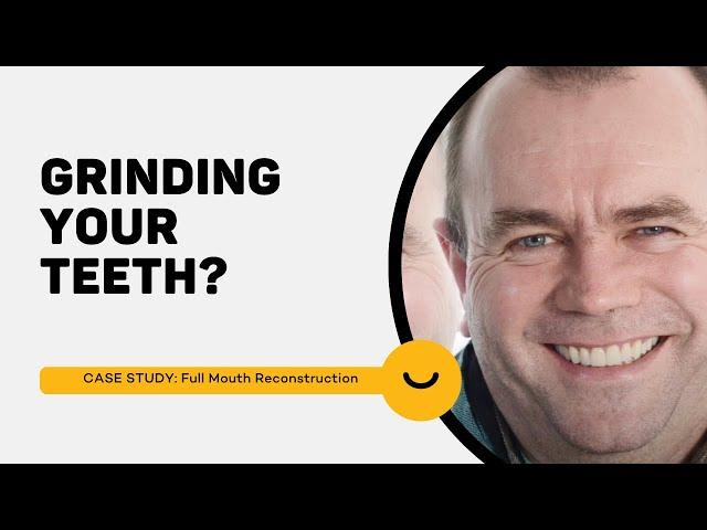 Grinding Your Teeth? Full Mouth Reconstruction - Brendan's Case