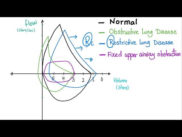 Flow Volume Loops - Respiratory Physiology - Pulmonary Medicine - Pulmonology Playlist