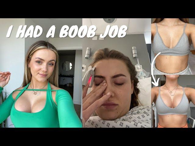 I HAD A BOOB JOB | Lets chat price, surgery, recovery and what I wish I knew