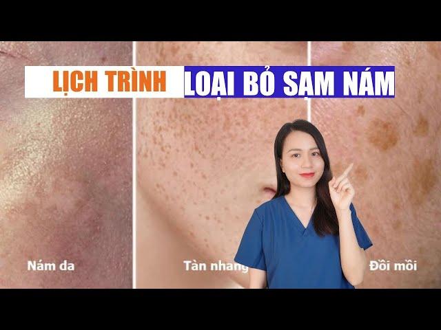 Lộ trình chi tiết xoá sạm nám ngay tại nhà - đơn giản nhất ! | Nguyễn Mai Hương