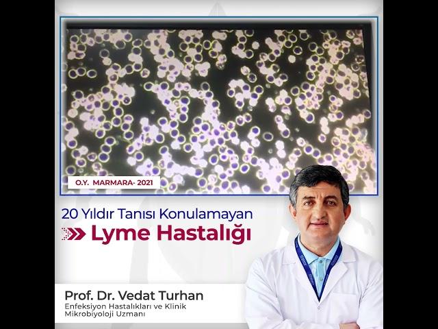 Another Lyme case without diagnosis 20 year. Prof Vedat Turhan darkfield microscopy