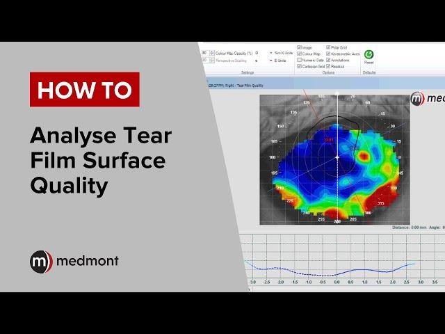 How To | Analyse Tear Film Surface Quality (Studio 6)