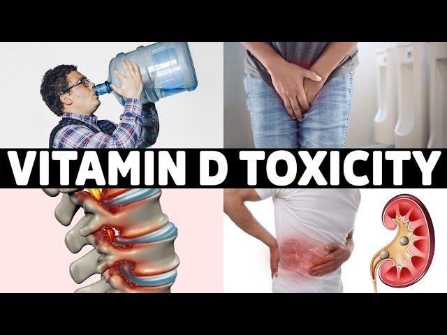 #1 Sign That You Overdosed on Vitamin D