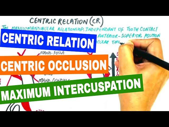 Centric Relation, Centric Occlusion & Maximum Intercuspation