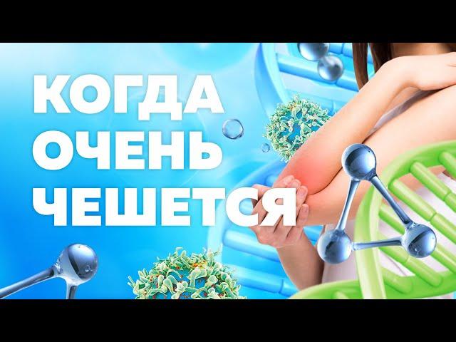 ЛЕЧЕНИЕ ПСОРИАЗА / КАК ИЗБАВИТЬСЯ ОТ ШЕЛУШЕНИЙ КОЖИ?