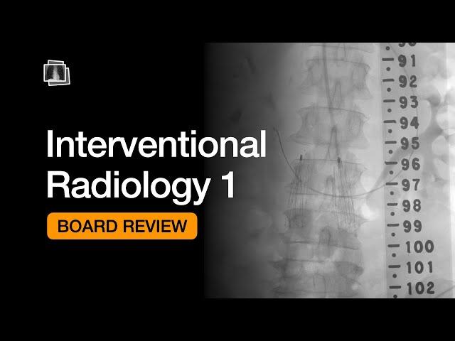 Interventional Radiology 1 | Board Review