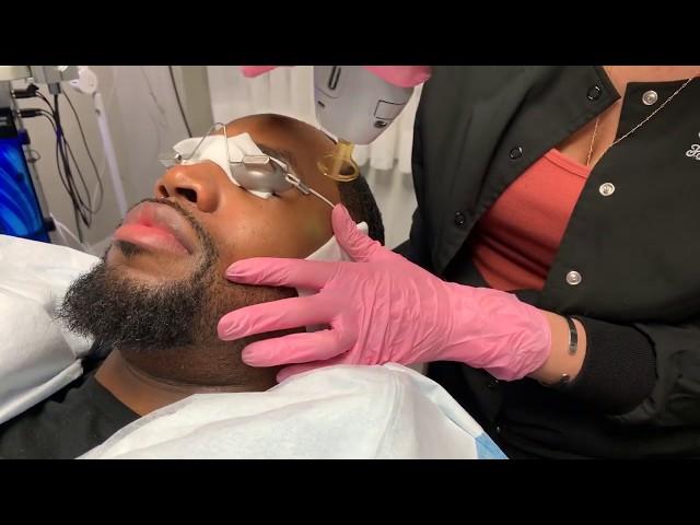 Gentlemax Pro Laser Facial | YAG 1064 Wavelength | New York, NY | Dr. Jason Ener x SAFAREE