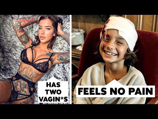 15 Real People With Extremely Weird Diseases