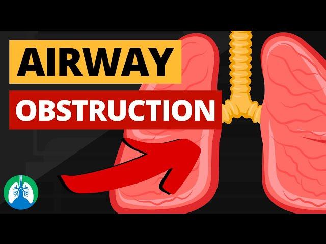 Airway Obstruction (Medical Definition) | Quick Explainer Video