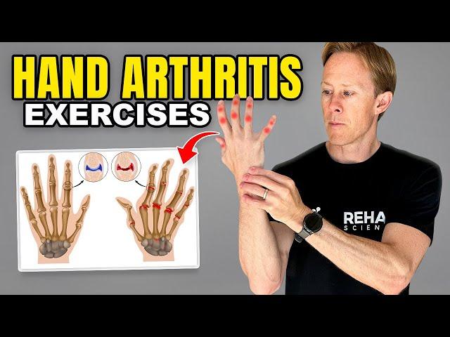 Hand Arthritis Exercises