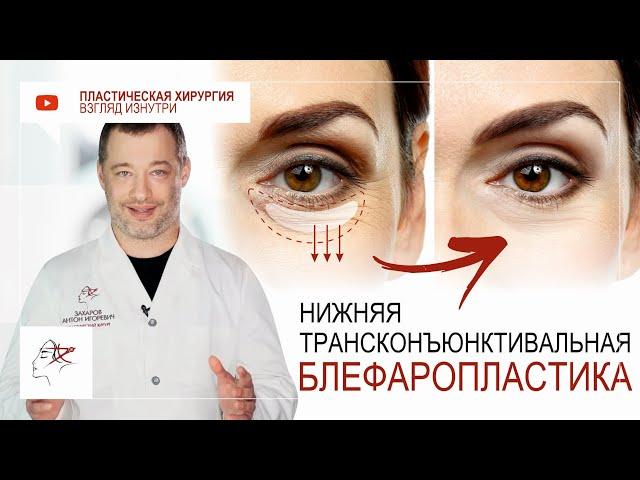 Нижняя трансконъюнктивальная блефаропластика