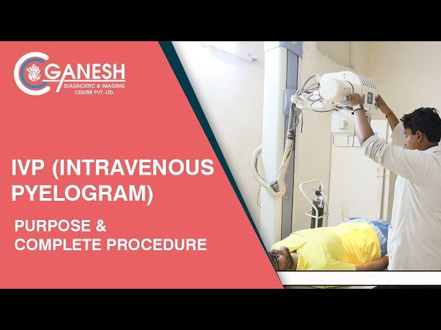 IVP (Intravenous Pyelogram) Test - Purpose & Complete Procedure at Ganesh Diagnostic