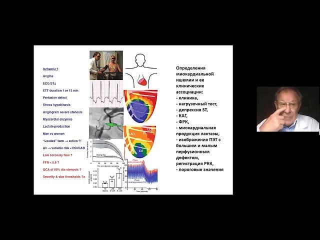 Лекция №4. Ишемия Миокарда. Профессор Сухов В.К.