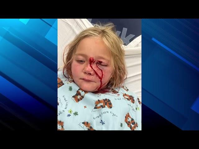 MI: Boy saves 6 year old sister from dog attack