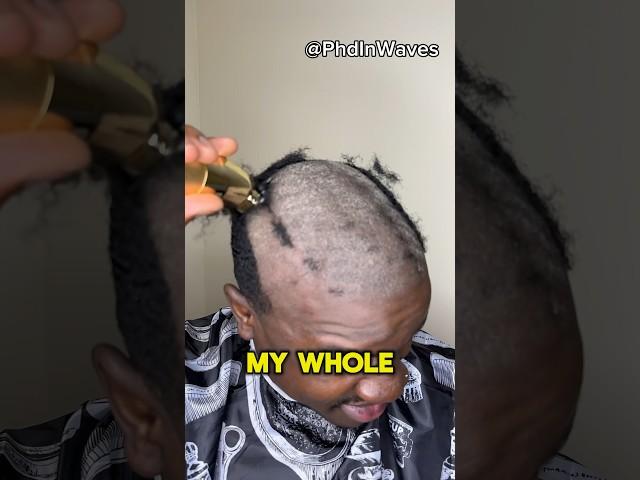 I scalped my 360 waves - bald head routine