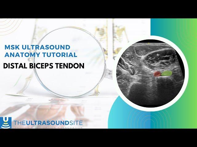 Anatomy tutorial of the distal biceps tendon and relevance to musculoskeletal ultrasound/sonography