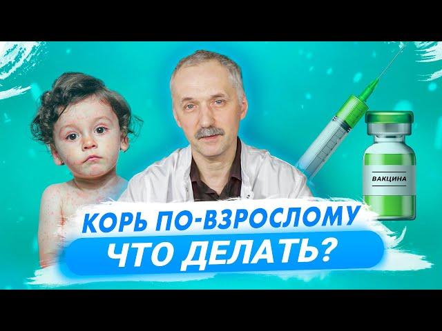 Вспышка кори в России. Симптомы кори и вакцинация / Доктор Виктор