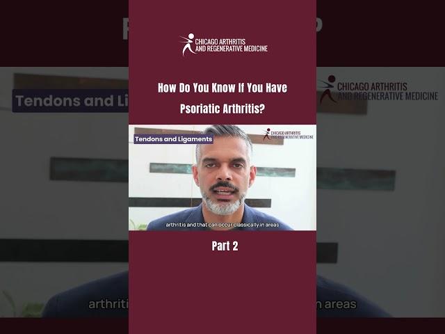 How Do You Know If You Have Psoriatic Arthritis? | PART 2 #PsoriaticArthritis #Rheumatology