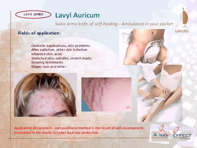 Lavylites - Lavyl Auricum Sensitive