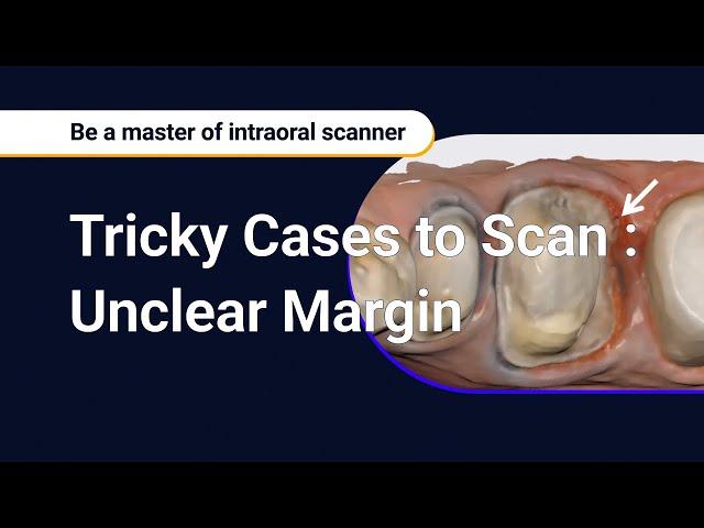 Tricky Cases to Scan : Unclear Margin