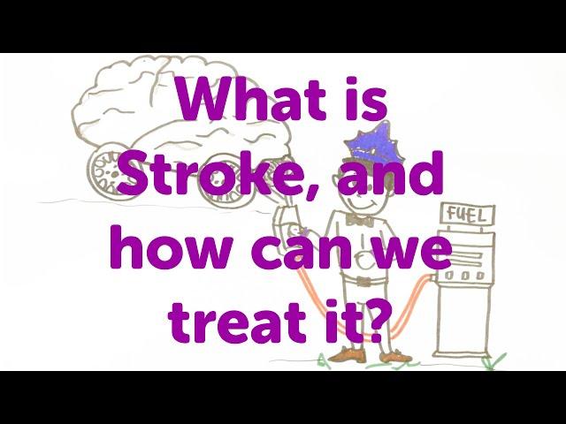 Minute Lectures: What is Stroke, and how can we treat it?