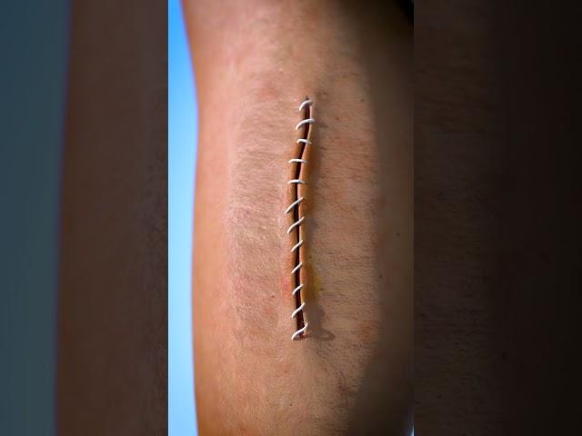 How Stitches Work 
