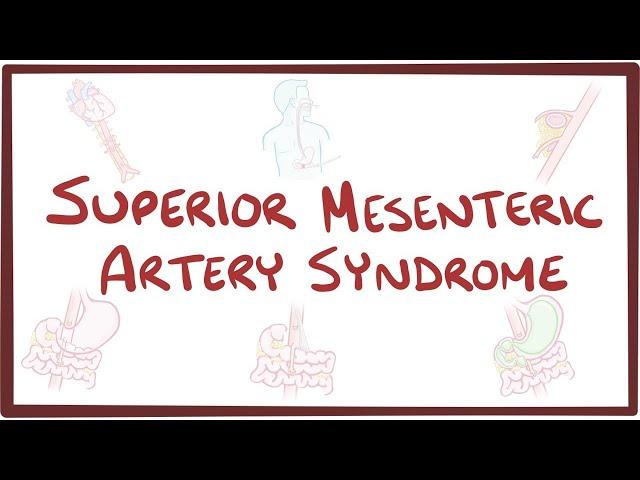 Superior mesenteric artery syndrome - an Osmosis Preview