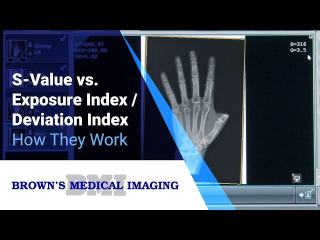 How-to Understand S-Value vs. Exposure Index / Deviation Index In Your Radiographic Images