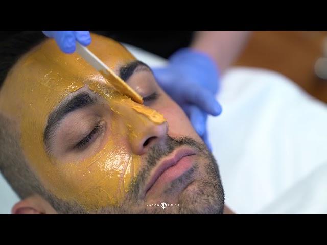 Removing Dark Spots with Enlighten Peel | Melasma Treatment | Hyperpigmentation Treatment