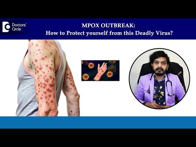 MPox Outbreak! How to Protect yourself from this Virus? - Dr. Leela Mohan P V R | Doctors' Circle