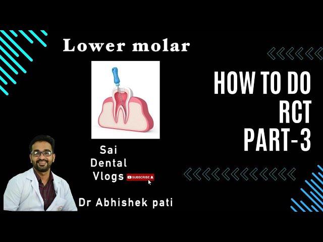 HOW TO DO RCT PART 3 / LOWER MOLARS