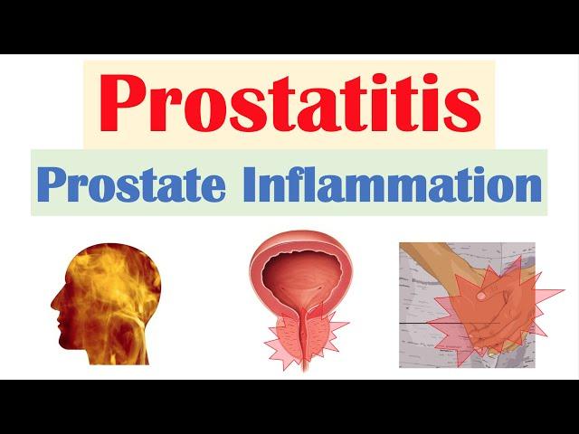 Prostatitis (Prostate Inflammation): Different Types, Causes, Signs & Symptoms, Diagnosis, Treatment