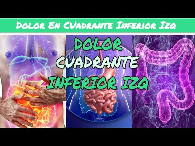 ️🩺 DOLOR EN LADO IZQUIERDO DEL ABDOMEN - Diverticulitis o Síndrome de Intestino Irritable