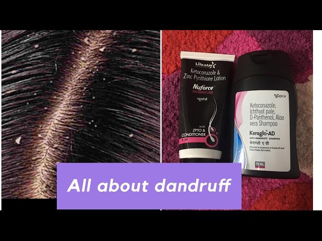 Dandruff Reasons and Treatment | Seborrheic Dermatitis | Nidhi Chaudhary