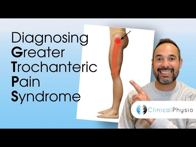 Diagnosing Greater Trochanteric Pain Syndrome | Expert Physio Explains