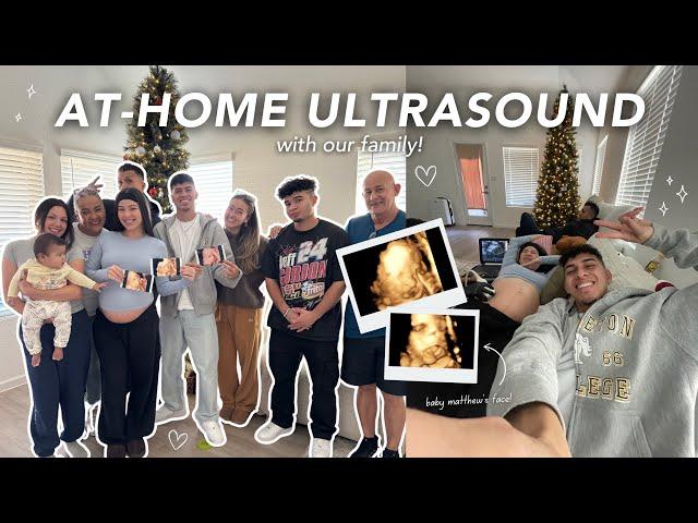 AT-HOME ULTRASOUND WITH OUR ENTIRE FAMILY!