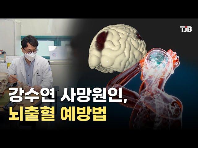 [닥터리포트]강수연 사망원인,뇌출혈 예방법｜ TJB 대전·세종·충남뉴스