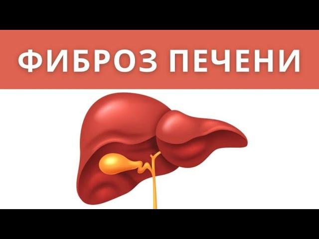 ФИБРОЗ печени. Как развивается, если есть гепатит С или жировой гепатоз