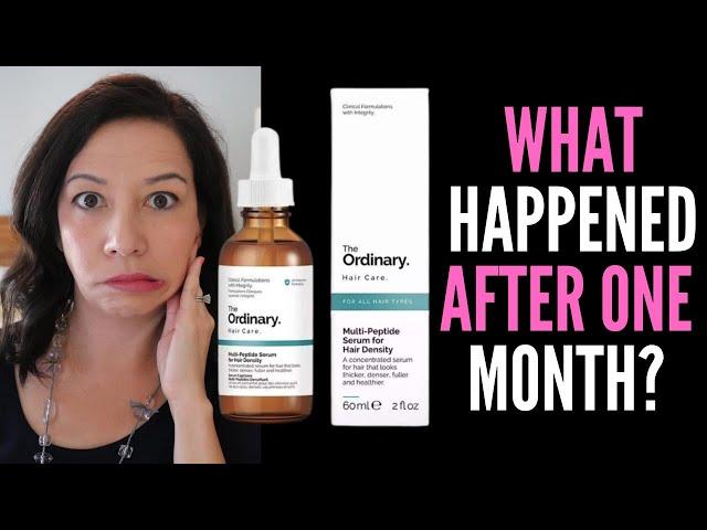 HAIR LOSS SUFFERER REVIEWS THE ORDINARY MULTI-PEPTIDE SERUM FOR HAIR DENSITY Best Hair Growth Serum?