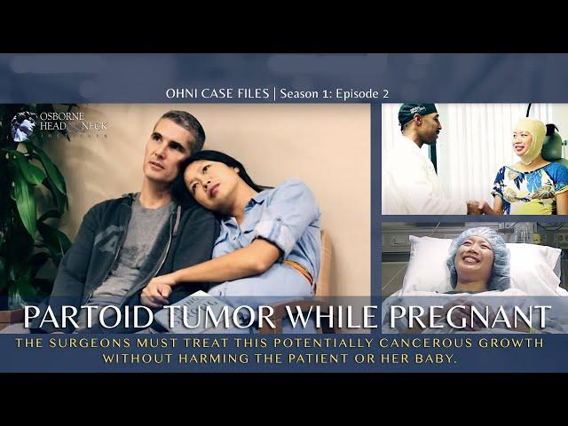 Pregnant Mom's LIFE-CHANGING Parotid Tumor Surgery Experience