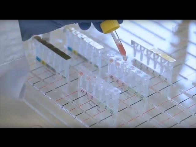 Mitochondriales Monitoring von Stoffwechseländerungen mittels optischer Systeme