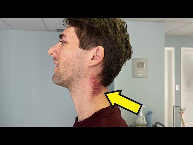 Man Goes To Doctor With A *Severely FROZEN* NECK  Lightheaded, DIZZY, Ear Ringing  Needs Help!