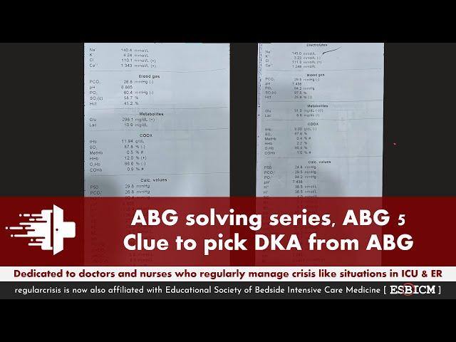 ABG solving series, ABG 5; Clue to pick diabetes ketoacidosis (DKA) from ABG | RegularCrisis