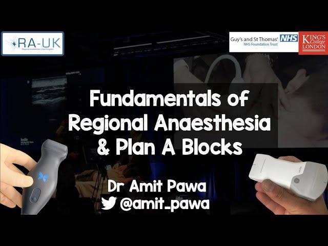 Fundamentals of Regional Anaesthesia & Plan A Blocks