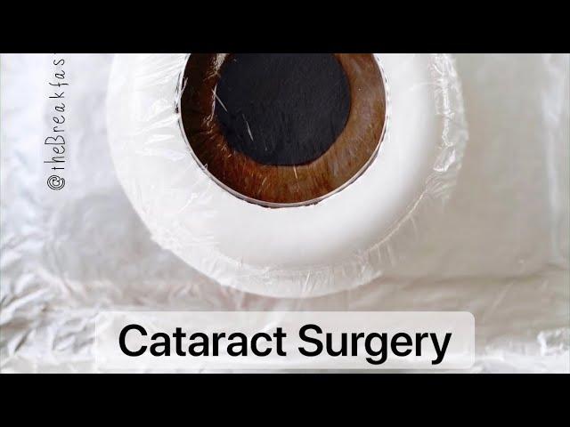 Playdough Surgery  - Cataract Surgery