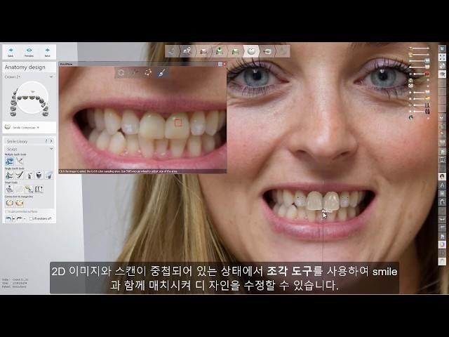 3Shape 덴탈시스템 - Realview engine - 3Shape Dental System - Realview engine