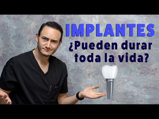 ¿Los Implantes Dentales duran toda la vida? | ¿Cuánto tiempo dura un implante dental?