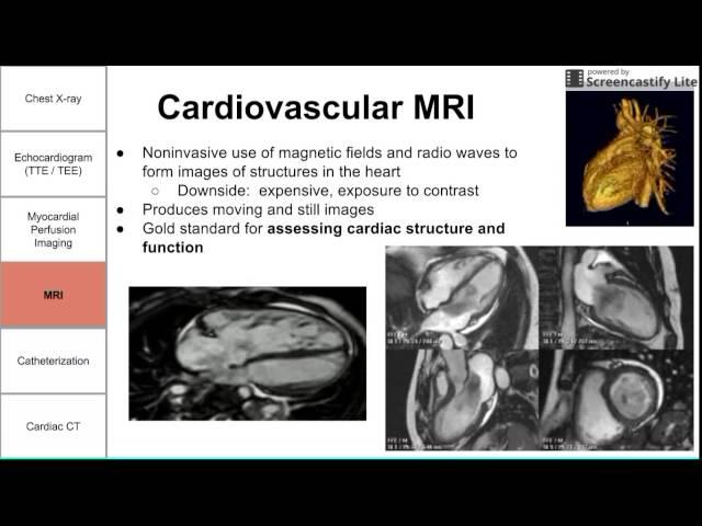 Cardiac Imaging Modalities